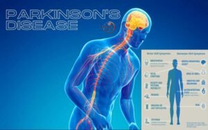 Parkinson's Disease Guide to Managing and Living with a Neurological Condition