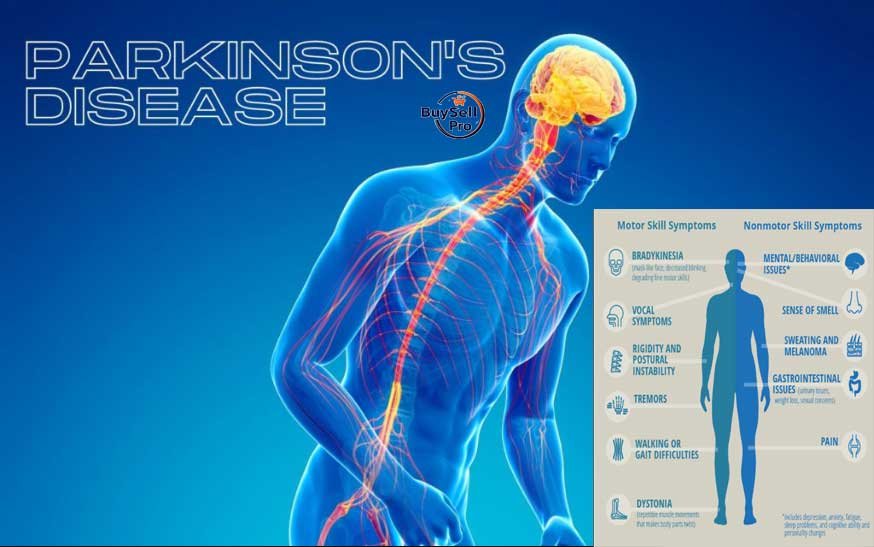 Parkinson's Disease Guide to Managing and Living with a Neurological Condition